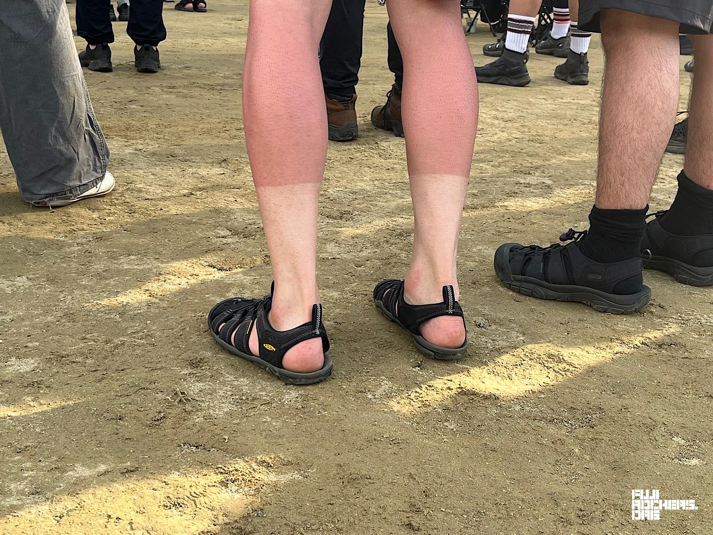 日焼け、、、